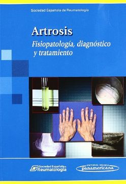 portada Artrosis. Fisiopatología, Diagnóstico y Tratamiento. (in Spanish)