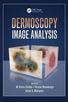 portada Dermoscopy Image Analysis (en Inglés)