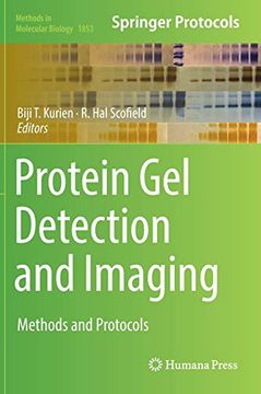portada Protein gel Detection and Imaging: Methods and Protocols (Methods in Molecular Biology) (en Inglés)