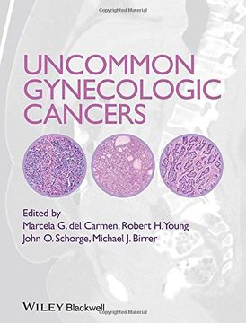 portada Uncommon Gynecologic Cancers (en Inglés)