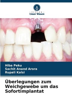 portada Überlegungen zum Weichgewebe um das Sofortimplantat (in German)