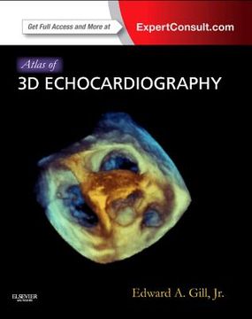 portada Atlas of 3D Echocardiography: Expert Consult - Online and Print (in English)