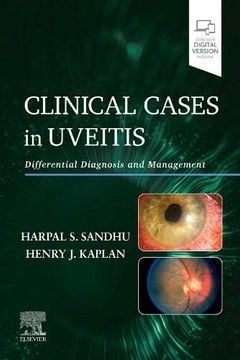 portada Clinical Cases in Uveitis: Differential Diagnosis and Management (en Inglés)