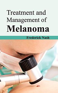 portada Treatment and Management of Melanoma 