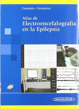 portada Atlas de Electroencefalografia en la Epilepsia