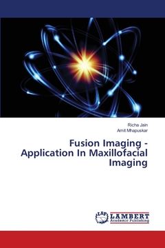 portada Fusion Imaging - Application In Maxillofacial Imaging (en Inglés)