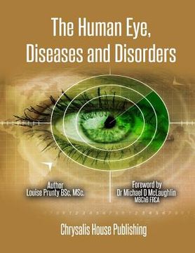 portada The Human Eye, Diseases and Disorders. (en Inglés)
