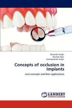 portada concepts of occlusion in implants (en Inglés)