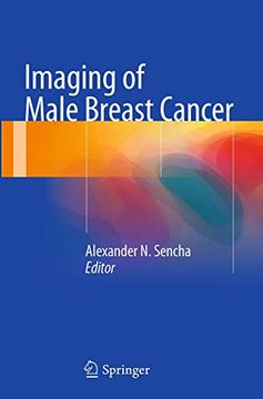 portada Imaging of Male Breast Cancer (en Inglés)