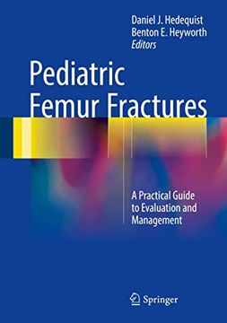 portada Pediatric Femur Fractures: A Practical Guide to Evaluation and Management (en Inglés)