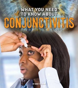 portada What You Need to Know about Conjunctivitis (Fact Finders: Focus on Health)