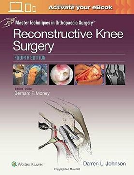 Master Techniques in Orthopaedic Surgery: Reconstructive Knee Surgery (en Inglés)