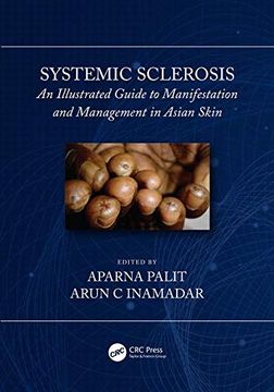 portada Systemic Sclerosis: An Illustrated Guide to Manifestation and Management in Asian Skin 