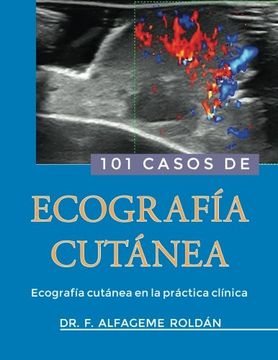 portada 101 Casos de Ecografia Cutanea: Ecografía Cutánea en la Práctica Clínica (in Spanish)