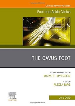 portada The Cavus Foot, an Issue of Foot and Ankle Clinics of North America, 1e: Volume 24-2 (The Clinics: Orthopedics) (en Inglés)