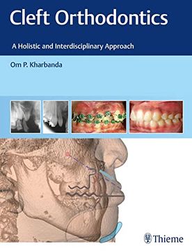portada Cleft Orthodontics: A Holistic and Interdisciplinary Approach (en Inglés)