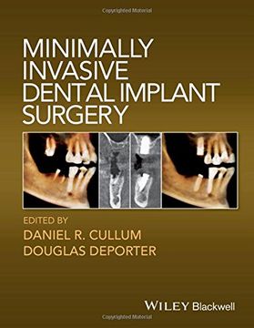 portada Minimally Invasive Dental Implant Surgery (en Inglés)