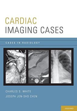 portada Cardiac Imaging Cases (Cases in Radiology) (en Inglés)