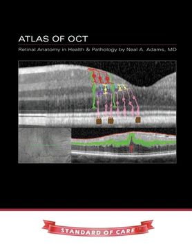 portada Atlas of OCT: Retinal Anatomy in Health & Pathology