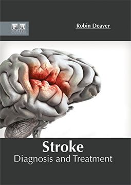 portada Stroke: Diagnosis and Treatment
