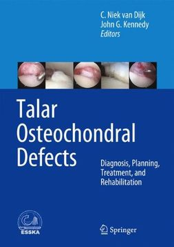 portada Talar Osteochondral Defects: Diagnosis, Planning, Treatment, and Rehabilitation