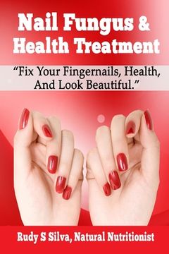 portada Nail Fungus & Health Treatment: Fix Your Fingernail's Health And Look Beautiful (en Inglés)