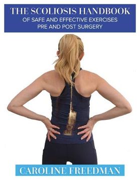 portada The Scoliosis Handbook of Safe and Effective Exercises pre and Post Surgery (en Inglés)