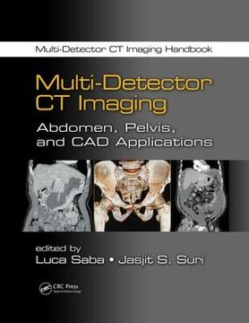 portada Multi-Detector CT Imaging: Abdomen, Pelvis, and CAD Applications (en Inglés)