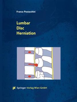 portada Lumbar Disc Herniation (en Inglés)