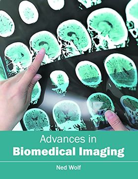 portada Advances in Biomedical Imaging (en Inglés)