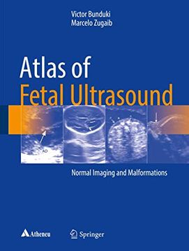 portada Atlas of Fetal Ultrasound: Normal Imaging and Malformations