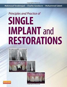 portada Principles and Practice of Single Implant and Restoration (en Inglés)