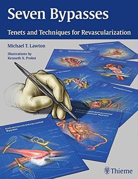 portada Seven Bypasses: Tenets and Techniques for Revascularization (in English)
