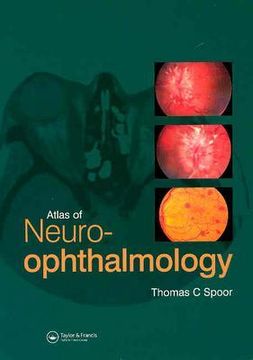 portada Atlas of Neuro-Ophthalmology (en Inglés)