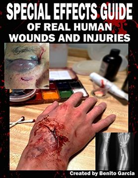 portada Special Effects Guide of Real Human Wounds and Injuries: Special Effects Guide of Real Human Wounds and Injuries (in English)