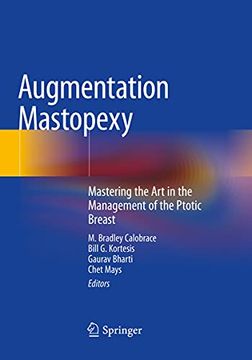 portada Augmentation Mastopexy: Mastering the Art in the Management of the Ptotic Breast (in English)
