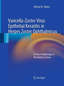 portada Varicella-Zoster Virus Epithelial Keratitis in Herpes Zoster Ophthalmicus: In Vivo Morphology in the Human Cornea (en Inglés)