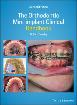 portada The Orthodontic Mini-Implant Clinical Handbook (en Inglés)