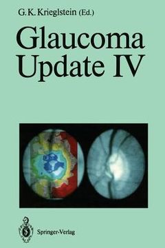 portada glaucoma update iv