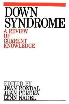 portada down syndrome: a review of current knowledge (en Inglés)
