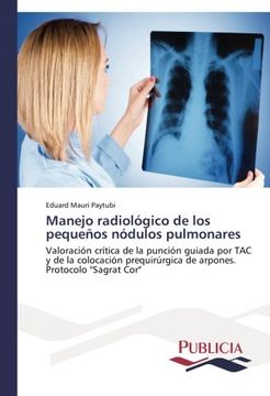 portada Manejo Radiologico de Los Pequenos Nodulos Pulmonares
