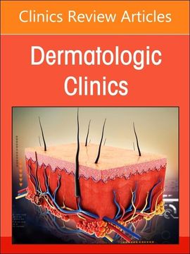 portada Psoriasis: Contemporary and Future Therapies, an Issue of Dermatologic Clinics (Volume 42-3) (The Clinics: Dermatology, Volume 42-3) (en Inglés)