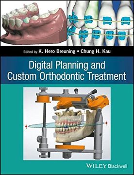 portada Digital Planning and Custom Orthodontic Treatment (en Inglés)