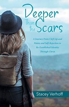 portada Deeper Than the Scars: A Journey From Cleft lip and Palate and Self-Rejection to Re-Established Identity Through Christ (en Inglés)