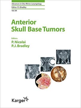 portada Anterior Skull Base Tumors (in English)