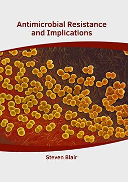 portada Antimicrobial Resistance and Implications (en Inglés)