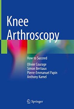 portada Knee Arthroscopy: How to Succeed (in English)