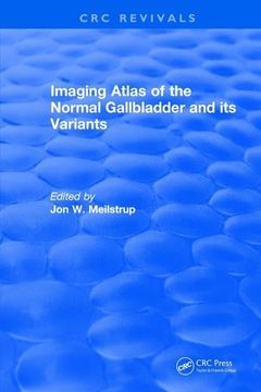 portada Imaging Atlas of the Normal Gallbladder and Its Variants (en Inglés)