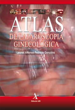 portada Atlas de Laparoscopia Ginecológica