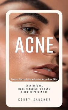portada Acne: Proven Natural Remedies for Acne-Free Skin (Easy Natural Home Remedies for Acne & how to Prevent it)